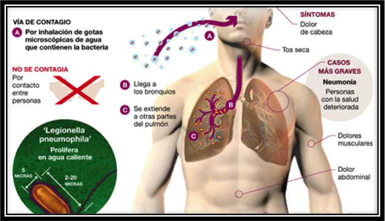 la legionella se contagia via respiratoria